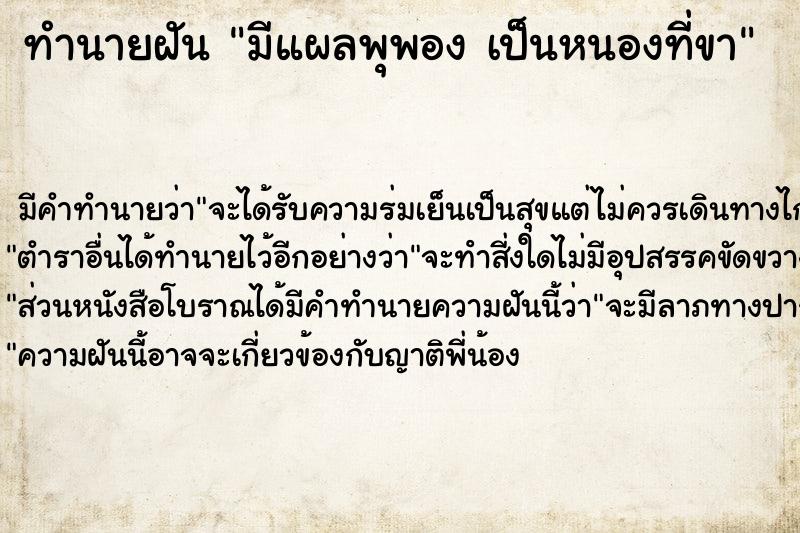 ทำนายฝัน มีแผลพุพอง เป็นหนองที่ขา